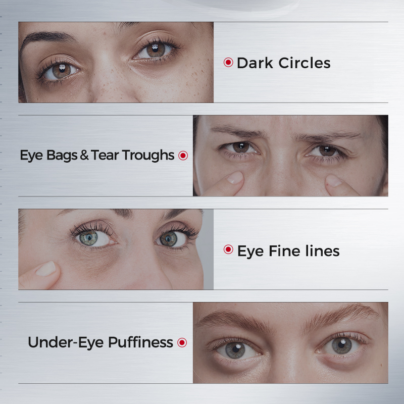 Eye Patches for Dark Circles – - đánh giá và giá Sheet Mask Collagen