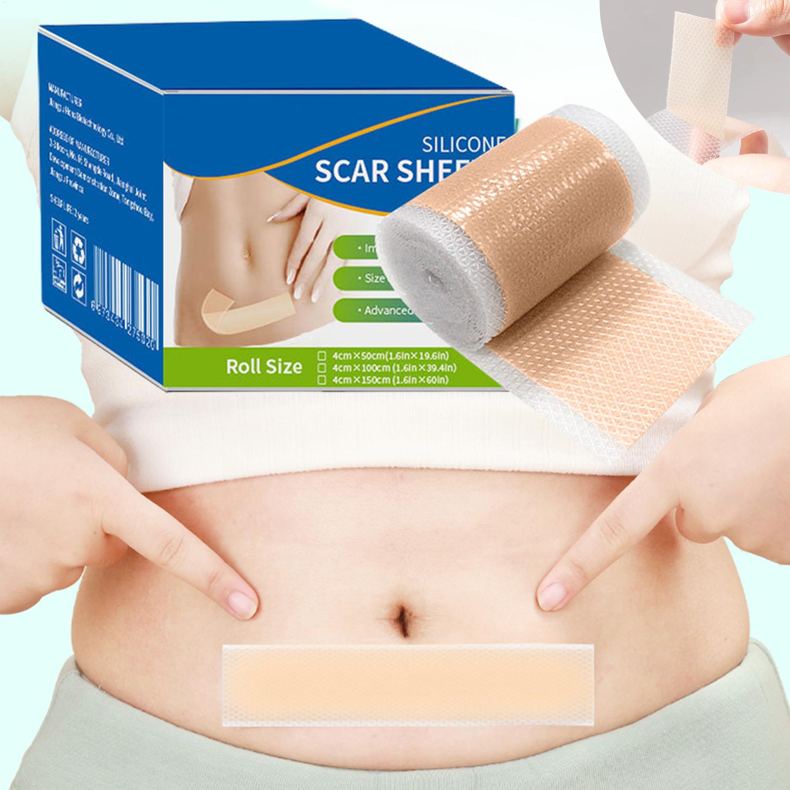 1 Roll Silicone Scar Sheets 4c - đánh giá và giá Sheet Mask Collagen